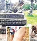 ▲ 앙코르와트 내 원숭이에게 공격을 받아 부상을 입은 모습